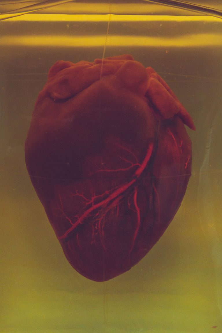 Abbildung Herz